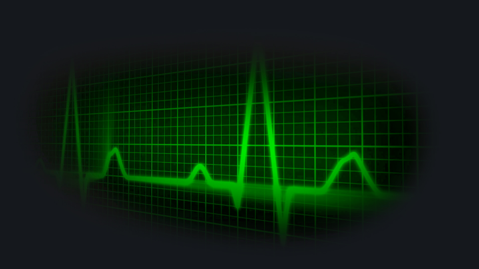 Cardiogram